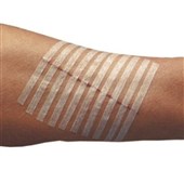 Sterile Wound Closure Strips